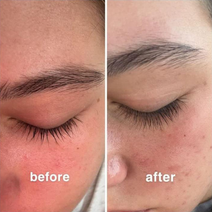 Eyelash Growth Serum