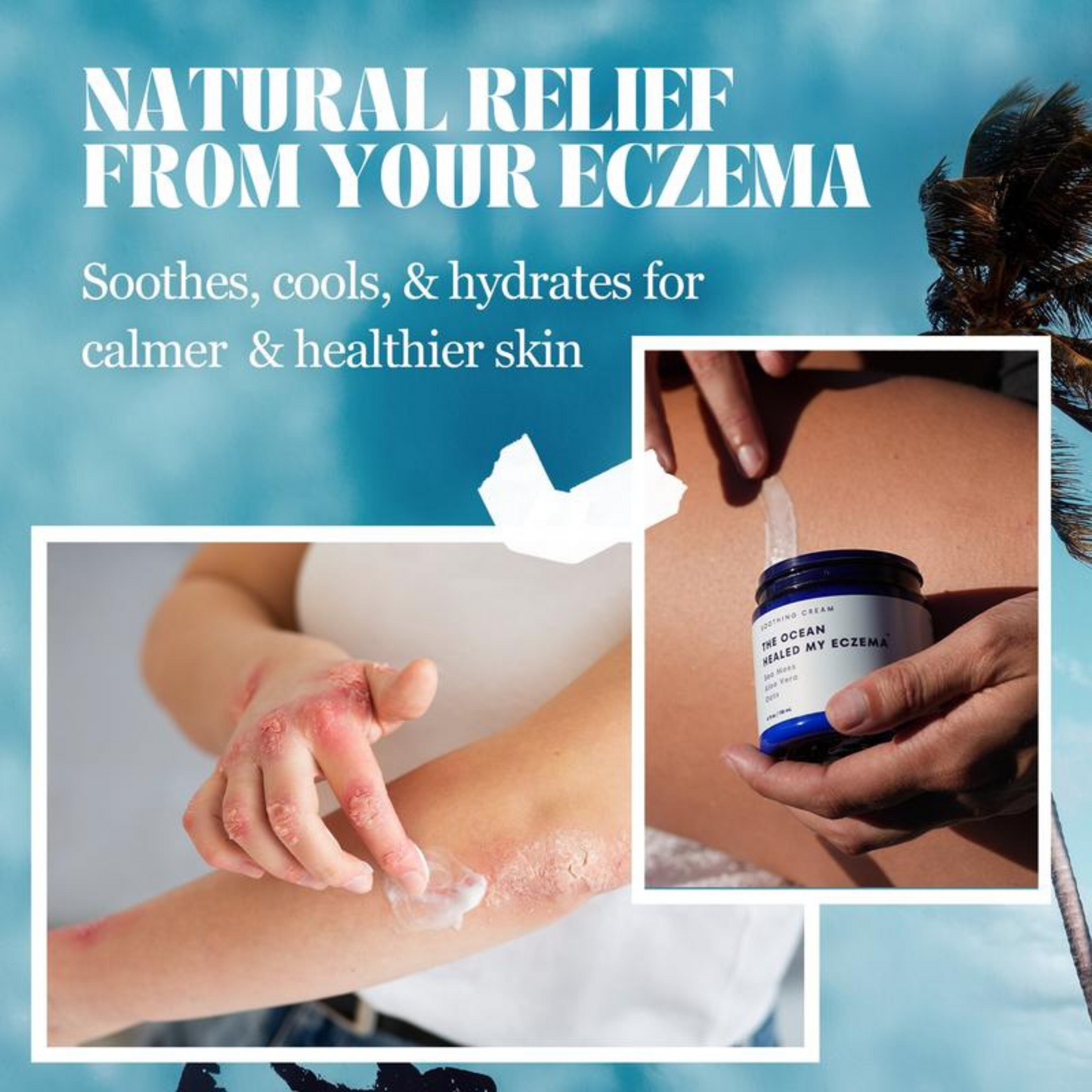 Overnight Eczema Relief Cream